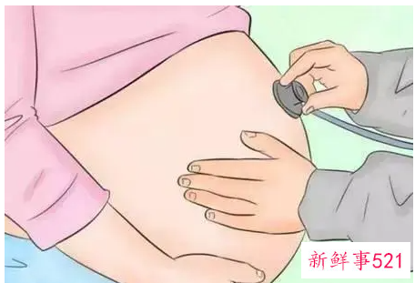 产检可筛查缺陷宝宝