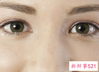 如何去除眼袋最有效