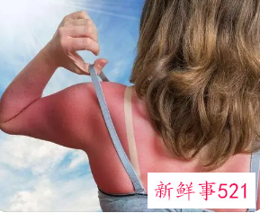 晒伤后可以恢复肤色吗