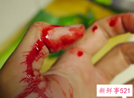 梦到自己出血是什么预示