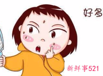 鼻翼长痘与卵巢吗