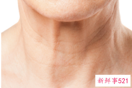 颈部有皱纹怎么办