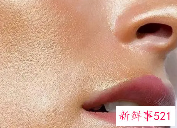 脸上出油严重是怎么回事