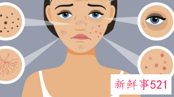 皮肤屏障受损如何治疗