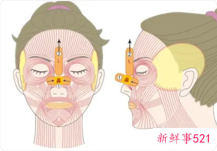 去皱的医美的方法