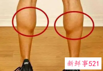 小腿越来越粗怎么改善