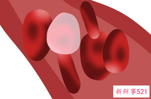 五个好习惯让血管健康常驻