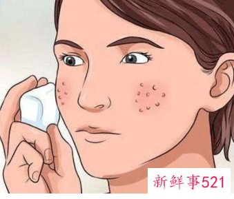 如何使毛孔粗大变小