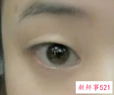 单眼皮的眼型有哪些