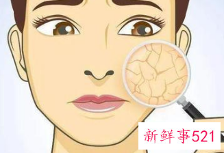 春天皮肤干燥起皮