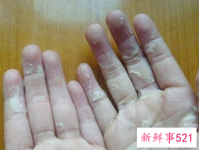 蜕皮现象是什么