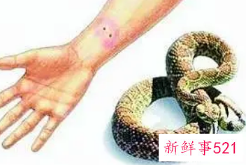梦见蛇并被咬了一口是什么预兆