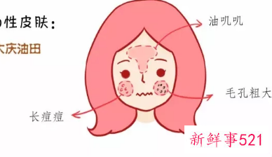 油性皮肤是什么样的