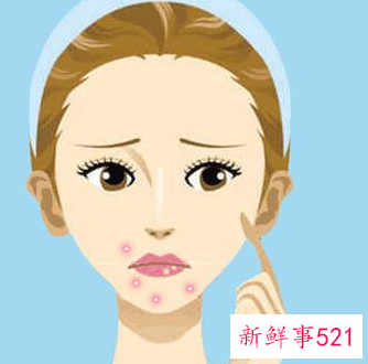 粉刺多怎么解决