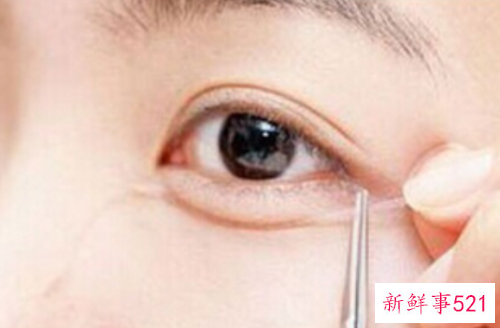 卧蚕和眼袋怎么区别