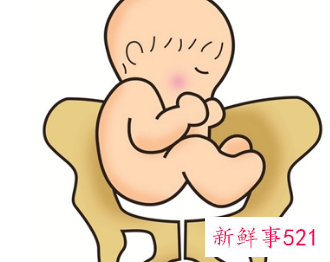 胎儿臀位孕妇少坐会怎么样
