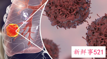 脂肪肝的症状有哪些表现