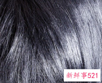 治疗脂溢性脱发方法