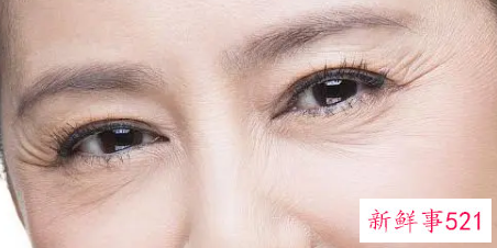 消除眼部皱纹的小妙招