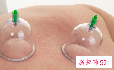女人拔罐有什么好处和坏处