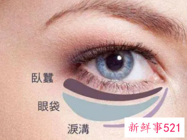 如何去除眼袋最有效