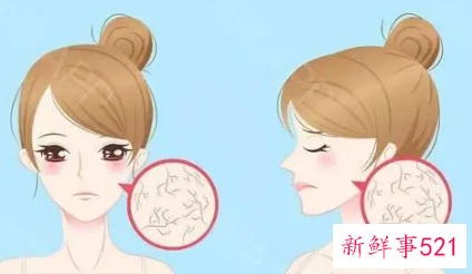 敏感性肌肤怎么护理改善