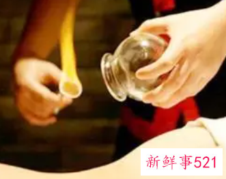 正确的拔罐方法
