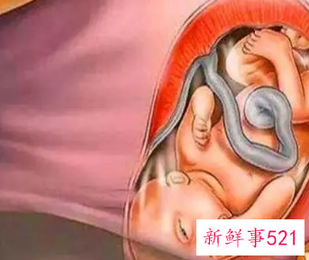 孕38周宝宝的样子