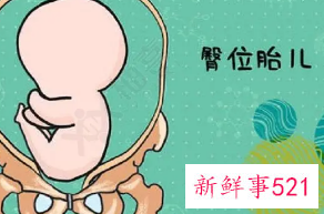 臀位多躺着好还是溜达好