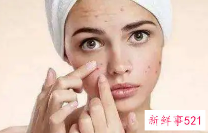 长痘痘要怎么办