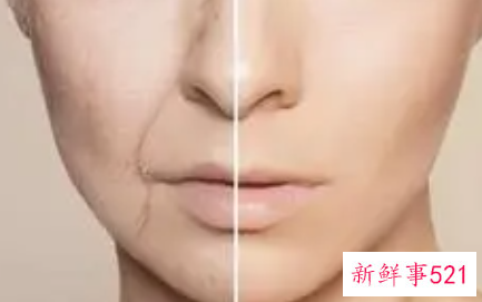 有效助你抗衰老的习惯