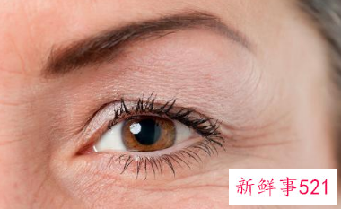 怎样淡化眼部皱纹最有效