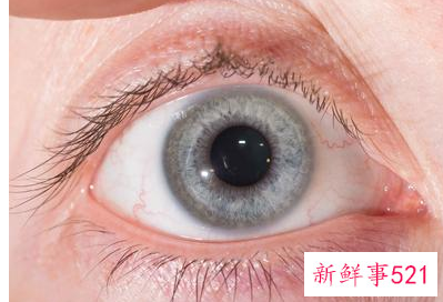 学生眼睛干涩有什么办法解决