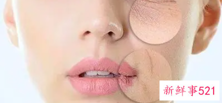 脸部皮肤缺水怎么办