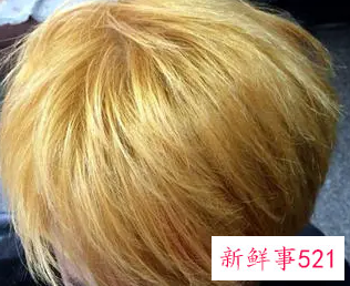 哪些伤发行为你知道吗