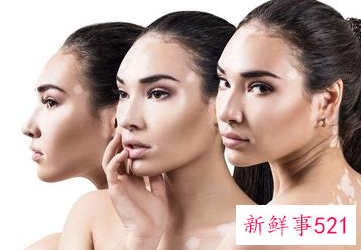 为什么脸上的黑色素沉积排不出来怎么办