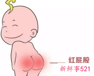 宝宝肛门周围红怎么办
