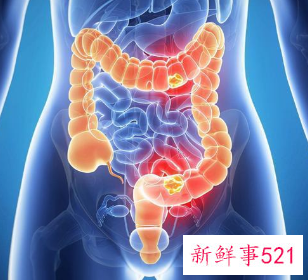 女性保养身体哪些部位