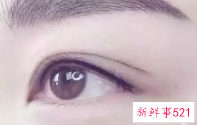 美瞳线后1至7天的变化图