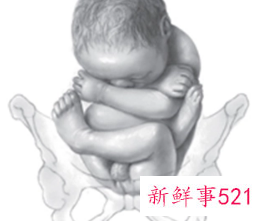 臀位多躺着好还是溜达好