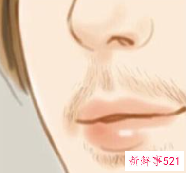 女生怎么去小胡子小妙招