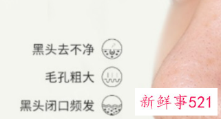 如何去除烦人的草莓鼻