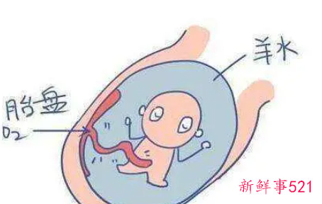 羊水少于多少必须催生