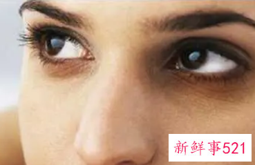 如何去除眼袋最有效