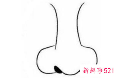 鼻子不好看怎么改善