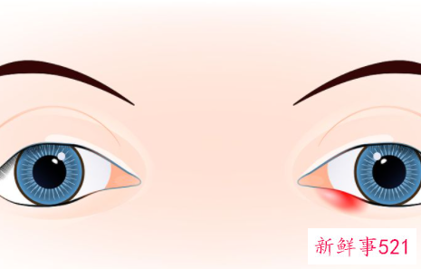 眼睛旁边凹陷是什么原因