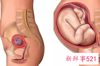 孕中期便秘的食疗方法