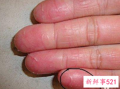 蜕皮现象是什么