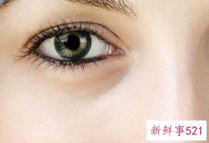 眼睛旁边凹陷是什么原因