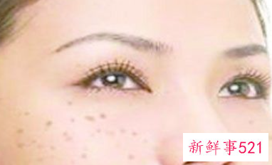 女人去皱纹有哪些方法